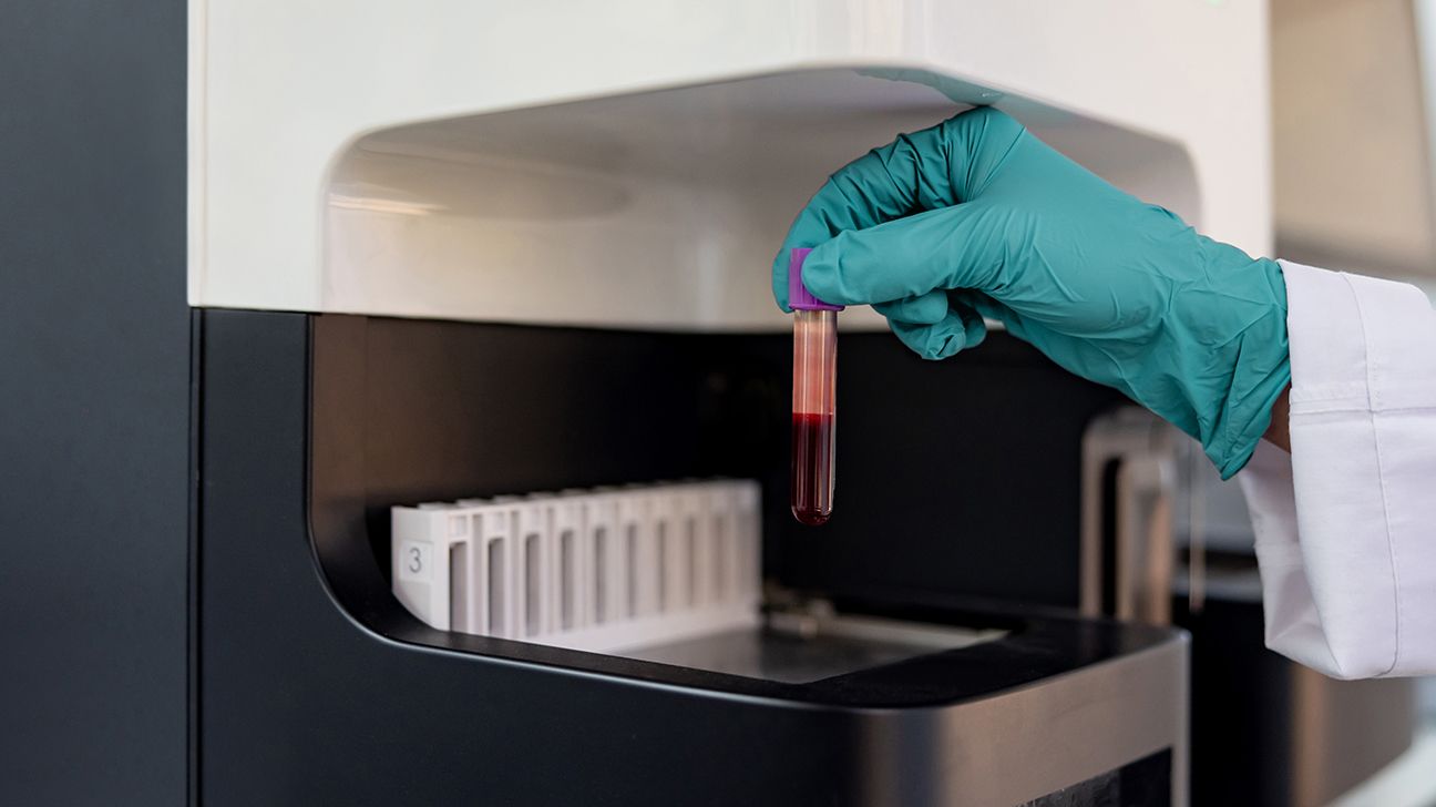 Lab technician takes a vial of blood.