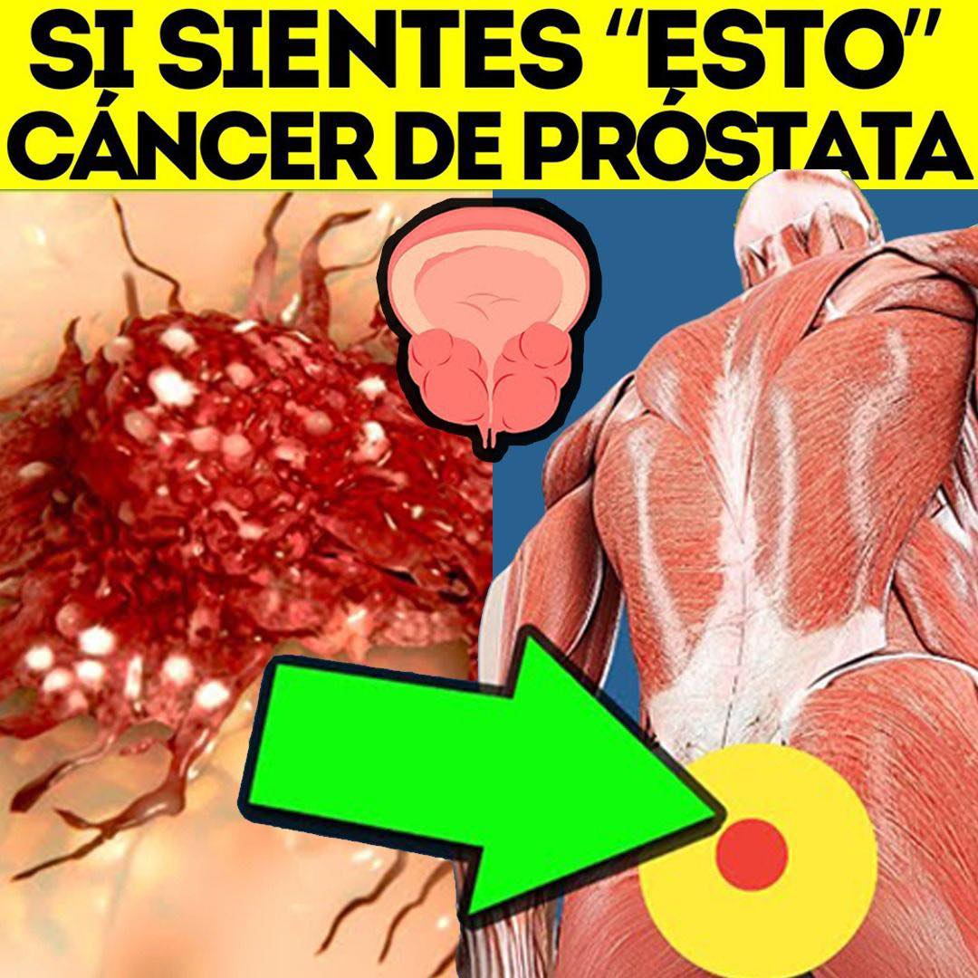 CÁNCER DE PRÓSTATA – Primeros SIGNOS y SÍNTOMAS ¡NO LO IGNORES!