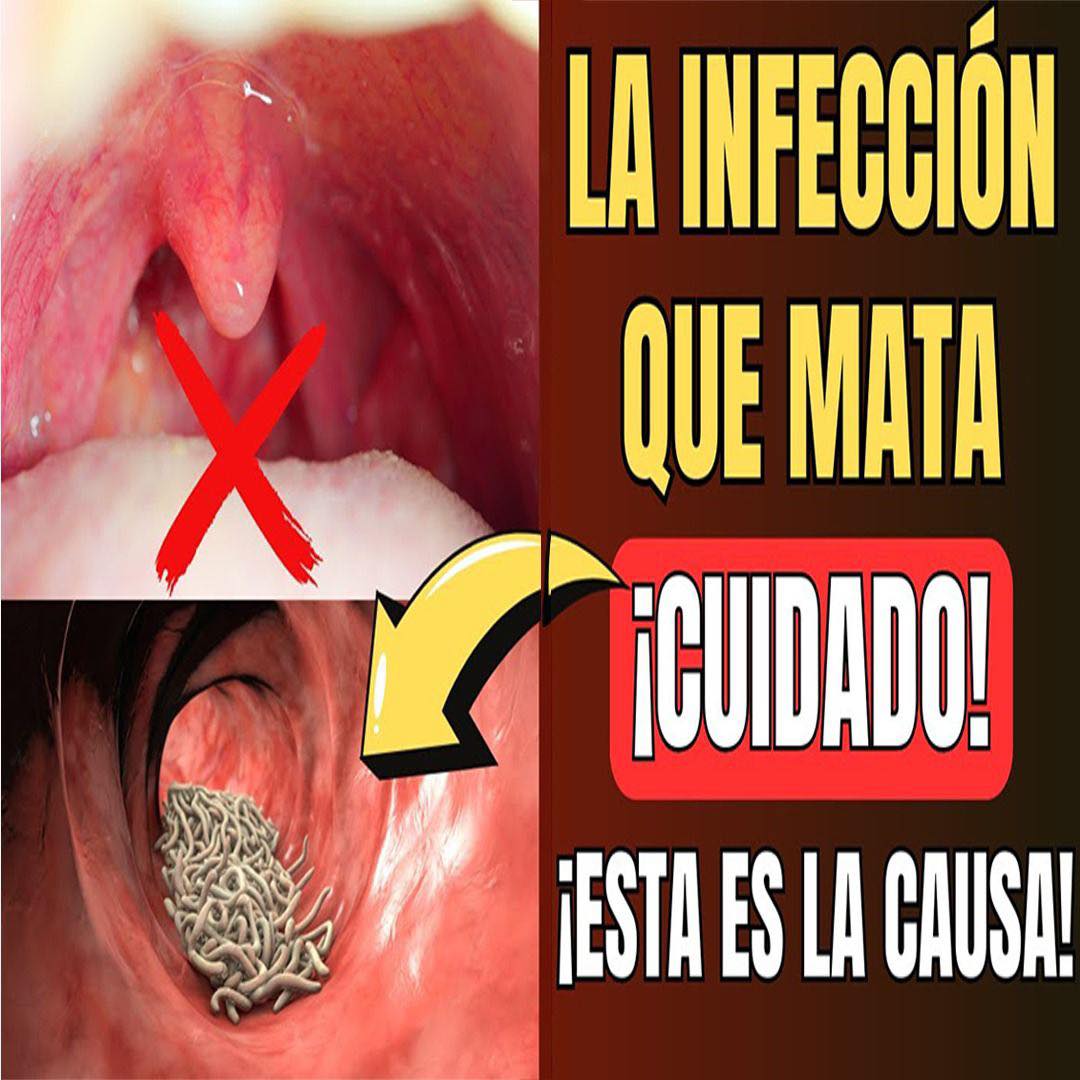 La PELIGROSA CAUSA de la FLEMA TÓXICA PERSISTENTE