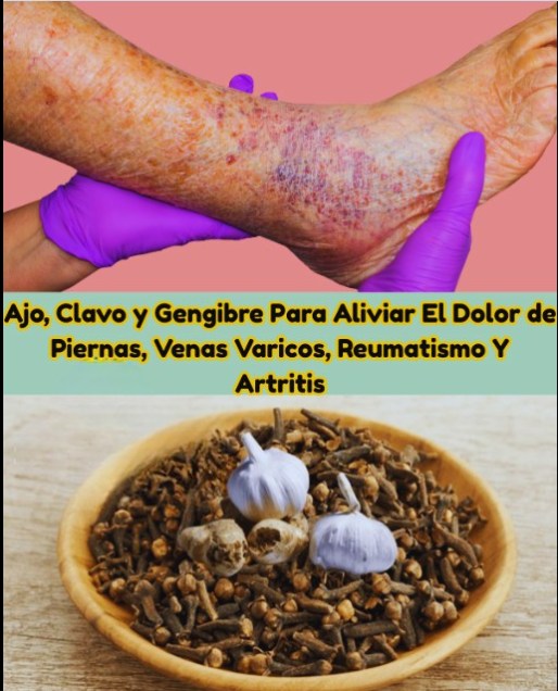 Receta con Ajo, Clavos y Jengibre para Aliviar el Dolor de Piernas, Reumatismo y Artritis