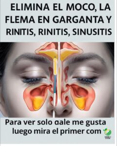 Elimina el Moco, la Flema en la Garganta y Nariz, y la Rinitis: Remedios Caseros