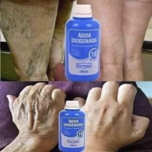Increíbles usos del agua oxigenada que seguro no conocías