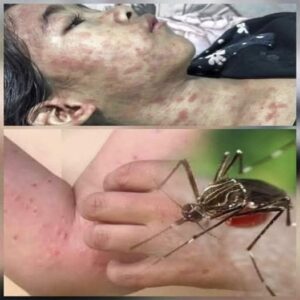 Consecuencias de dormir con la ventana abierta en época de mosquitos