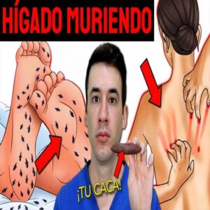 10 señales tempranas de daño hepático que no debes ignorar