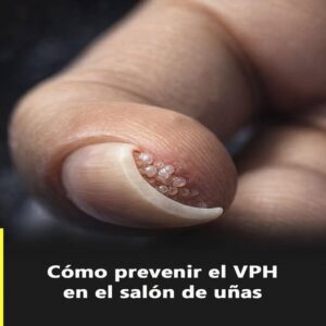 VPH: Conociendo el Virus, Síntomas y Remedios Naturales para Combatirlo