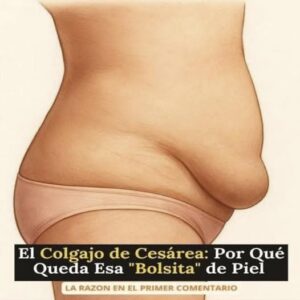 ¿Por qué queda esa bolsita de piel colgando después de una cesárea?