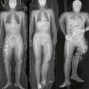 Si te pusiste la vacuna del COVID debes saber esto