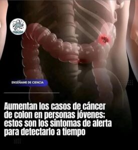 ¡Desintoxica tu Colon Naturalmente! Descubre Estos 5 Alimentos Clave»