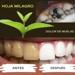 Cómo blanquear los dientes y prevenir las caries de forma natural: trucos y consejos que realmente funcionan Cómo blanquear los dientes y prevenir las caries de forma natural: trucos y consejos que realmente funcionan