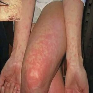 MEJOR SERA QUE SEPAS ESTO SI TIENES UNO DE ESTOS PUNTOS ROJOS EN TU CUERPO