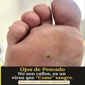 Ojo de pescado: qué es realmente y por qué no debe confundirse con un simple callo