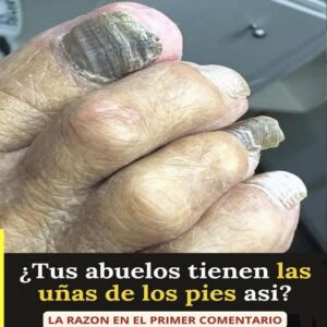 “Uñas de viejo”: qué significan estos cambios y por qué aparecen con el paso de los años “Uñas de viejo”: qué significan estos cambios y por qué aparecen con el paso de los años