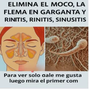 Elimina el moco, la flema en la garganta y nariz, y dile adiós a la rinitis de forma natural
