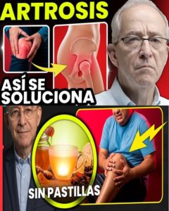 Artrosis: 9 palancas naturales para moverte con menos dolor y más libertad