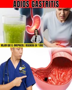 Si tu estómago arde por gastritis, prueba esta bebida con estrategia Si tu estómago arde por gastritis, prueba esta bebida con estrategia