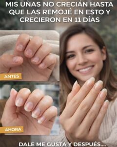 Uñas largas en 10 días: el ritual con aceite de ajo que podría cambiar tus manos Uñas largas en 10 días: el ritual con aceite de ajo que podría cambiar tus manos