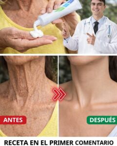 Cómo cuidar la piel de tus manos y brazos de forma natural para un aspecto más suave y uniforme