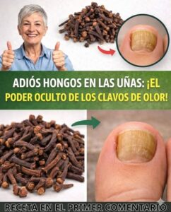 eliminar hongos en las unas clavos de olor