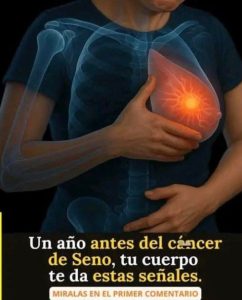 Cáncer de mama: 4 señales tempranas que toda mujer debe conocer