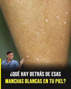 Manchas Blancas en la Piel: Qué Indican y Por Qué Aparecen con el Paso del Tiempo Manchas Blancas en la Piel: Qué Indican y Por Qué Aparecen con el Paso del Tiempo