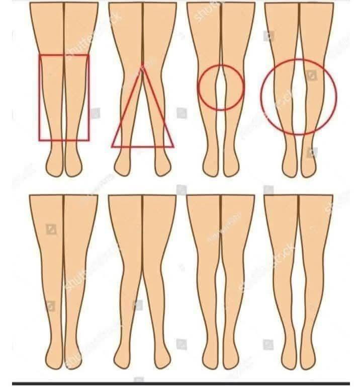 ¿La forma de tus piernas puede revelar tu personalidad? Esto es lo que muchos creen